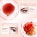 Retinol Eye Cream for Dark Circles and Puffiness Retinol Serum Under Eye Cream Stick Reducing Wrinkles and Fine Lines Moisturizing and Tightening Treatment Cream Smooth and Hydrate Skin - Buy Online on GoSupps.com
