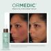 Buy IMAGE Skincare ORMEDIC Balancing Antioxidant Serum - Hydrating & Soothing with Aloe Vera & Vitamin C - 1 fl oz - Ships Internationally - Buy Online on GoSupps.com
