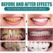 Ampoule Toothpaste Essence Ampoule Toothpaste Teeth Whitening Ampoule Toothpaste Tartar Plaque Toothpaste Tartar and Plaque Removal - Buy Online on GoSupps.com