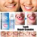 XIRUJNFD Tooth Repair Granules Temporary Tooth Repair Kit Temporary Tooth Filling Kit Tooth Repair Granules Kit Temporary Tooth for Everyone 2Pcs - Buy Online on GoSupps.com