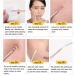 Blackhead Remover Pimple Popper Tool Kit - Professional Acne Extractor Set for Face & Nose - Blemish Whitehead Extraction Tools in Rose Gold Case - Buy Online on GoSupps.com