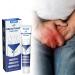 Antibacterial Ointment Antifungal and Antipruritic Cream 30g Private Antibacterial Ointment Guitouyan Ointment Deodorizing and Antifungal Cream and Male Antipruritic Cream for External Use