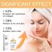 Glycolic Acid 7% Exfoliating Toner 7% Glycolic Acid Toner for Acne Prone Skin Glycolic Acid 7% Toning Solution for Blemishes and Acne Face Toner for Oily Skin Hydrating Toner Minimises Pores - Buy Online on GoSupps.com