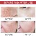 Correcting Face Serum Spot Remover For Face Color Correcting Serum Brightening Serum Face Serums Moisturiser Face Whitening Serum Anti Aging Serum For Face Skincare - Buy Online on GoSupps.com