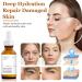 Retinol Serum for Face Retinol 1% in Squalane Reduce the Appearances of fine Lines of Photo Damage and of General Skin Ageing Acne Reduced Brighten & Smooth Skincare for Women & Men - Buy Online on GoSupps.com