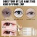 Eyelid Tape for Hooded Eyes 480 pcs Double Eyelid Stickers for Droopy & Uneven Invisible Eyelid Lift Strips Eyelid Lift Strips Lids by Design Eyelid Strips Waterproof & Sweat Resistant Eye Lift - Buy Online on GoSupps.com