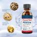 Fungal Nail Treatment - Toenail Treatment Extra Strong Nail Repair - Premium Fungal Nail Eliminator - Anti fungus Nail Repair and Strengthen Fix & Renew Damaged Broken Nails - Buy Online on GoSupps.com