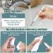 LMECHN Ear Wax Removal Kit with 1080P Otoscope - Earwax Remover Tool with LED Light for iPhone, iPad, Android Phones - White - Buy Online on GoSupps.com