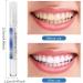 Professional Teeth Whitening Kit - 2x Teeth Whitening Abbey Essence for Gentle & Fast Results - Buy Online on GoSupps.com