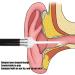 LED Ear Inspection Light for Ear Wax Removal & Hearing Aid Fitting - Pocket Clip & Reusable Penlight for Nursing Students - Buy Online on GoSupps.com
