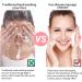 Silicone Face Cleaning Brush - Waterproof Manual Brush for Men & Women | Pink Skin Care Tool for Cleaning & Peeling - Buy Online on GoSupps.com