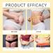 Bee Venom Slimming Oil Bee Venom Drops Bee Venom Intestinal Detox Belly Button Drops Bee Venom Belly Button Drops Bee Venom Oil Bee Venom Lymphatic Drainage Oil Tightening & Shaping Curve Body 2 - Buy Online on GoSupps.com