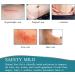 Silicone Scar Removal Tape | Soften & Flatten Scars | Waterproof Skin Tone Repair | Effective Beauty Scar Treatment - Buy Online on GoSupps.com