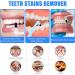 Quelcc 3-Piece Toothbrush Set | Stain & Tartar Remover | Soft Ricket Brush for Professional Tooth Cleaning | Remove Discoloration & Plaque - Buy Online on GoSupps.com