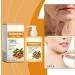 Turmeric Body Lotion Turmeric Body Lotion Improve Skin Tightening Deep Hydration Repair Dry Skin Turmeric Body Treatment Lotion For Smooth Skin (3) - Buy Online on GoSupps.com