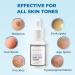 Abera Dark Spot Serum - Dark Spot Corrector for Melasma & Age Spots | Moisturization & Pore Minimizer | All Skin Types | 0.68 fl Oz A - Upgrade Version - Buy Online on GoSupps.com