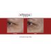 Fillerina 12 Densifying-Filler - Intensive Filler Treatment Grade 3 (2x30ml) - Buy Online on GoSupps.com