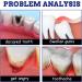 2 Pi ces Soulagement Rapide Dental Spray Dental Pain Analg sique Spray Herbal Oral Care Spray Dental Pain Relief Spray Soulage Les Gencives Douloureuses Enfl es Caries - Buy Online on GoSupps.com