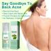 Back Acne Treatment Spray Acne Body Spray Adolescent Acne Treatment Body Moisturiser For Dry Skin Acne Moisturiser Repair Back Shoulder Acne & Body Acne & Chest Acne - Buy Online on GoSupps.com