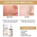 2 Pack Turmeric Dark Spot Corrector Serum - Natural Face Serum for Dark Spots Moisturizing & Repair (30ml) | Best Skin Care Solution - Buy Online on GoSupps.com