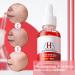 Friut Acid Face Serum for Acne Mark Salicylic Acid Anti Wrinkle Serum Fade Ance Mark & Shrink Pore Face Serum Hyaluronic Acid Acne Repair Serum for Sensitive Skin Smoothing Hyaluronic Serum-30ml - Buy Online on GoSupps.com