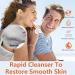 Azelaic Acid Acne Cream with Aloe Extract - Oil Control & Deep Cleaning for Sensitive Skin - Moisturizing Anti-Acne Skin Care - Buy Online on GoSupps.com