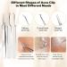 iSmartPart 20Pcs Blackhead Remover Tools Kit - Professional Stainless Steel Acne Extraction Set for Face and Nose - Buy Online on GoSupps.com