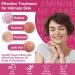 Maximum Strength Feminine Care Cream | Anti-Itch Relief for Rashes Eczema Jock Itch & Psoriasis - 3.53oz (100g - Buy Online on GoSupps.com