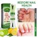 Feulover Nail-Biting & Thumb-Sucking Treatment for Kids & Adults - Bitter Taste Nail Care Solution with Safe Natural Plant Extract - 0.35 Fl Oz - Buy Online on GoSupps.com