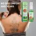 Tatouages | Cr me tatouages pour enlever les tatouages permanents | Cr me tatouages permanents pour tatouages color s et noirs produit 30 ml - Buy Online on GoSupps.com