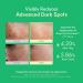 Easydew DW-EGF Melatoning Ampoule 5X - Hydrating Dark Spot Serum with Niacinamide & Glutathione for Uneven Skin - Fast Absorbing Day & Night Ampoule Korean Skin Care (Pump 0.27 fl oz EGF 5X) - Buy Online on GoSupps.com