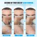 New Year Promotion: Scar Cream for Face and Body Repair - Reduces Surgery and C-Section Scars - 0.7 oz - Buy Online on GoSupps.com