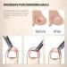Feryes Nail Tongs for Ingrown Toenails & Thick Nails | Stainless Steel Straight Blade & Sharp Tip | Professional Podology Tool - Buy Online on GoSupps.com