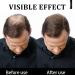 Hair Building Fibers Natural Hair Fibers for Men & Women Hair Fibres Dark Brown Hair Powder for Thinning Hair Easily Cover & Waterproof Hair Loss Concealer Instantly Conceals Hair Loss Soft Powder - Buy Online on GoSupps.com