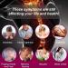 Cervical Neck Traction Device - Rose Red Neck Support for Pain Relief & Spinal Pressure Relief - Buy Online on GoSupps.com