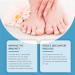 Fingernail Care Device | Nail Treatments Care Device for Damaged Nails Versatile Professional Fingernails & Toenails Repair Device for Normal Abnormal Nails - Buy Online on GoSupps.com