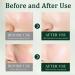 Tea Tree Acne Cream 50g - Spot Cream for Acne & Pimple - Dark Spot Remover for Face - Blackhead Remover Cream - Skin Care Face Cream for Women - Oil Control Soothing and Moisturizing Pimple Cream - Buy Online on GoSupps.com