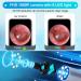 1080P WiFi Ear Cleaner Camera with 8 Pcs Ear Set - Blue | Ear Wax Removal Tool with Light | Waterproof Ear Wax Remover Compatible with iPhone and Android - Buy Online on GoSupps.com