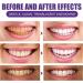 Purple Teeth Whitening Powder - V34 Purple Corrector & Stain Remover for Coffee Smoking & Tea (2PCs) | Effective Teeth Whitening Solution - Buy Online on GoSupps.com