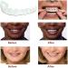 XLBHSH 2-Piece Provisional Dentures Set - Multifunctional Temporary Tooth Repair for Perfect Smiles - Safe Plastic Cosmetic Teeth for Upper & Lower Jaw - Buy Online on GoSupps.com