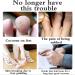 Cuttable Toe Tube Sleeves 5 Pack - Elastic Fabric & Silicone Gel Protectors for Bunion Hammer Toe Callus Blister - International Shipping - Buy Online on GoSupps.com