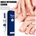 Flysmus 7 Days Nail Recovery Rapid Growth Essence Pen Natural 7 Days Nail Growth and Strengthening Serum Nail Growth & Strengthening Oil Serum for Thin Nails and Growth 20ml (2PCS) - Buy Online on GoSupps.com