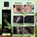 New 2026 Organic Rosemary Hair Growth Shampoo Rosemary Hydrolyzed Keratin Shampoo Volumizing For Thinning Hair & Hair Loss Nourishes & Repairs Hair Strands Unisex Formula 1Pcs - Buy Online on GoSupps.com