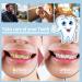 Electric Tooth Polisher & Dental Calculus Remover - 5 Heads USB Charge Waterproof | Household Oral Care Solution - Buy Online on GoSupps.com