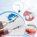 1000pcs Dental Orthodontic Separator Bulk Pack | Elastic Orthodontic Ties for Effective Dental Care - Buy Online on GoSupps.com