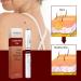 Wipe Off Tags & Moles Remover Fast Easy Effective Quick & Safe Remove Skin Tags Moles Remover Pen 1/2/3/5 PCS - Buy Online on GoSupps.com