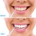 Patelai 100-Piece Interdental Brush Set - Effective Tooth Cleaning Tools for Oral Hygiene | Black White Gray Toothpick Flossers - Buy Online on GoSupps.com
