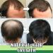 7 Day Herm Germinal Serum - Organic Hair Regrowth Kit | Accelerate Hair Growth & Prevent Hair Loss - Buy Online on GoSupps.com