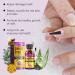 (100% 5 star) Bee Venom Nail Care Solution Foot Care Soothing Serum | Soft Nail Cream with Brush Head for Athletes Foot | Thick Toe Care | Thick | Broken | Discolored or Damaged Nail - 15ML/0.51FL.OZ (3pcs Bee Venom Nail Care Solution) - Buy Online on GoSupps.com