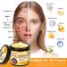 LOVILDS Bee Venom Skin Restoration Cream Professional Bee Venom Skin Treatment Cream Bee Venom Comprehensive Cream-50g Moisturizing & Repair Reduces Blemishes for All Skin Type (1 Bottle) - Buy Online on GoSupps.com